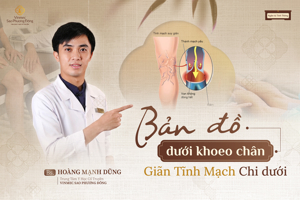 Bản đồ dưới khoeo chân – Giãn tĩnh mạch chi dưới