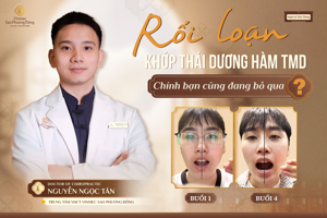 Rối loạn khớp thái dương hàm (TMD) – Nhận diện, chẩn đoán và hướng điều trị